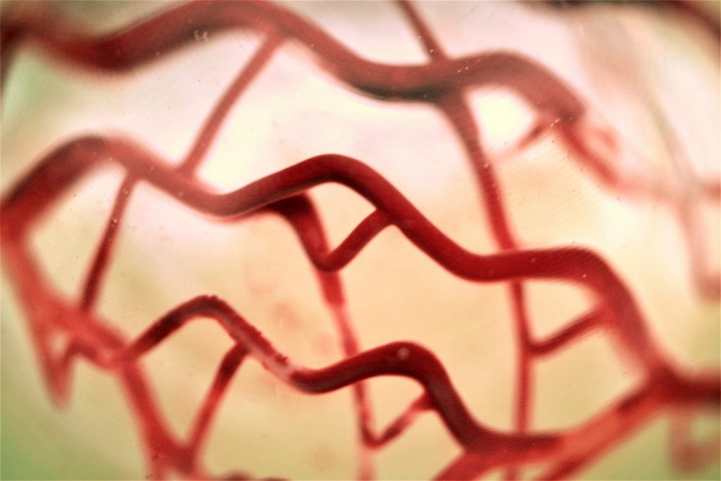 3D bioprinted soft tissue scaffold with vascularization channel designed and produced by 3D Systems and CollPlant