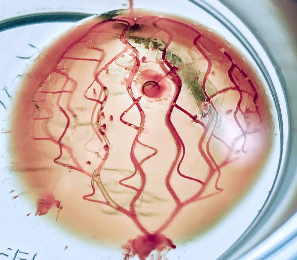 3D bioprinted soft tissue scaffold