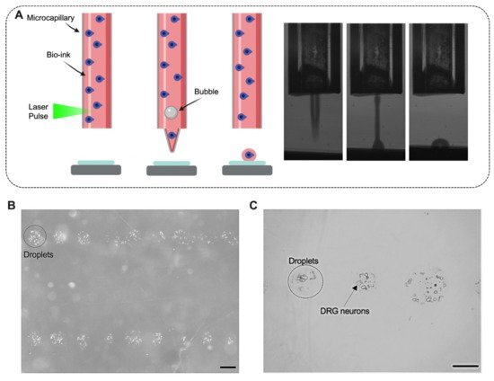 Laser-induced lateral transfer of neurons (LIST)