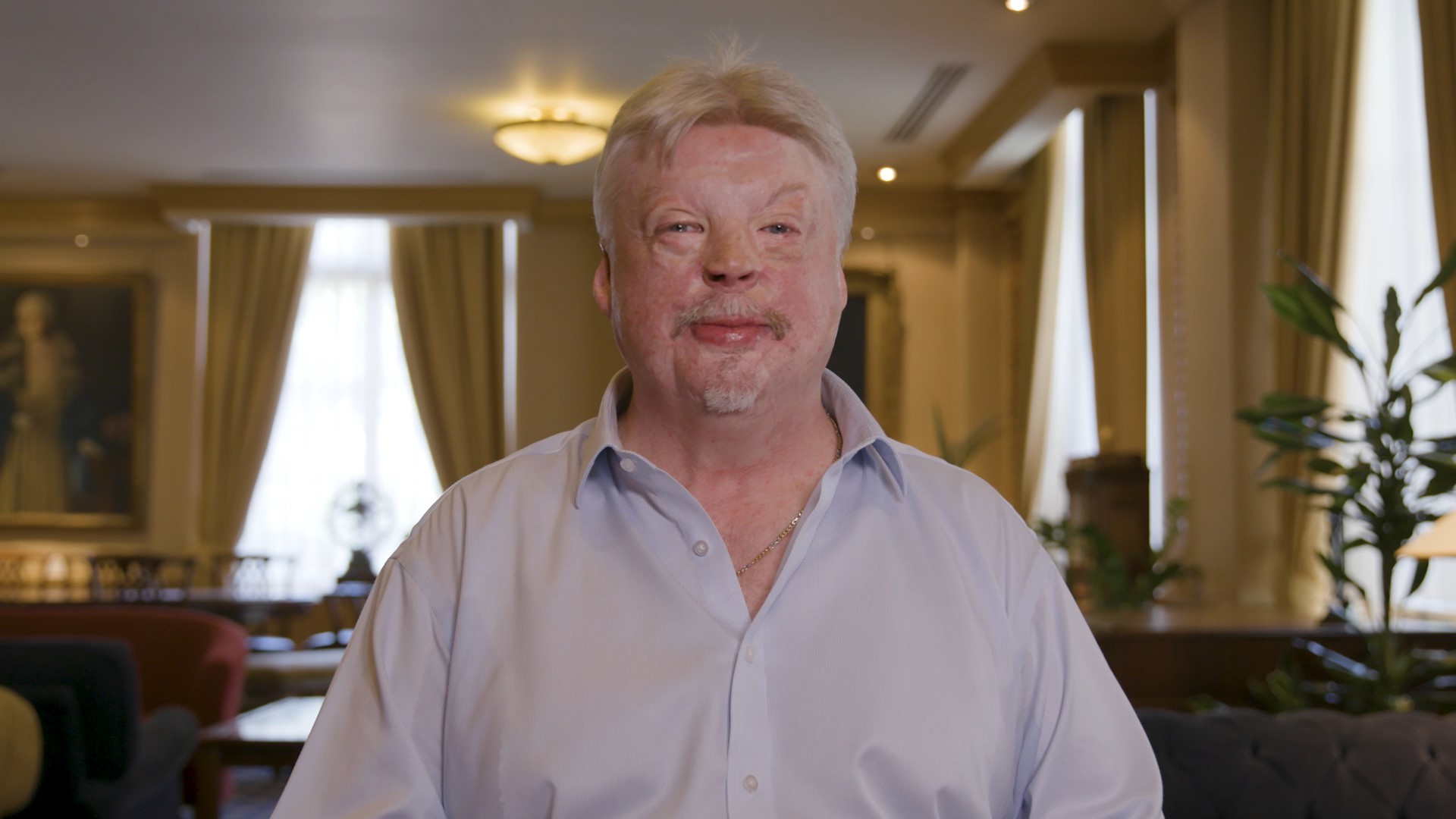  Simon Weston CBE, Chief Ambassador of Unscarred Foundation