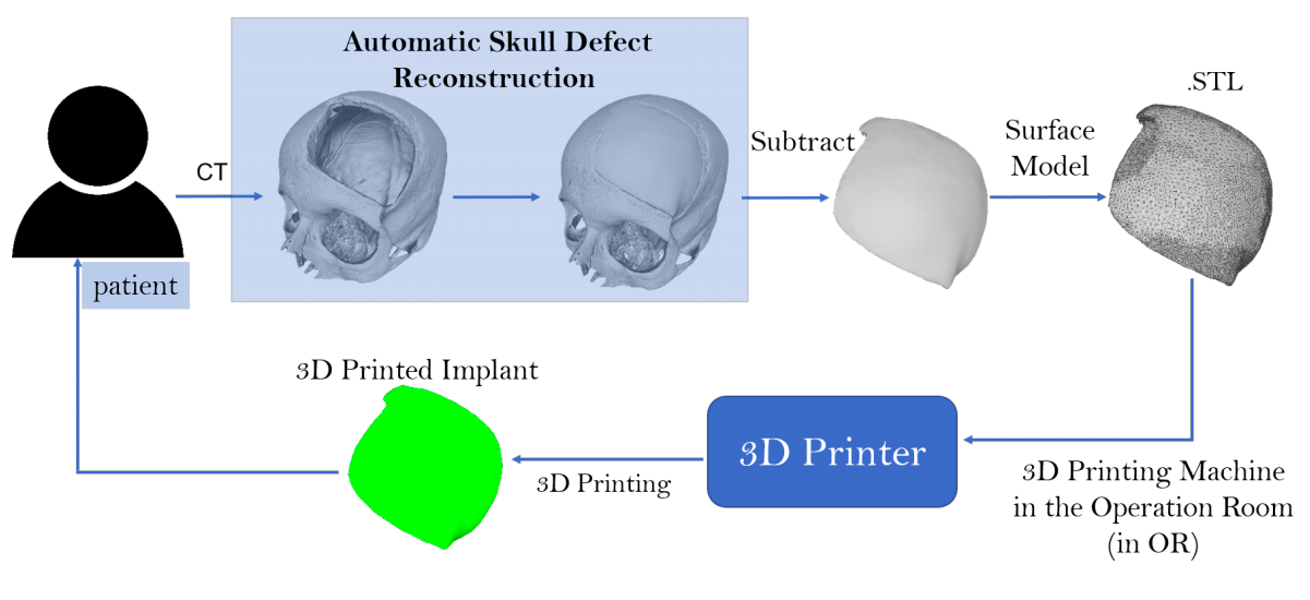  The research team’s new automated procedure allows manufacturing and design to be performed entirely in the same hospital as the patient