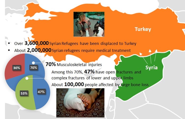 Infographic of refugees in Syria in Turkey