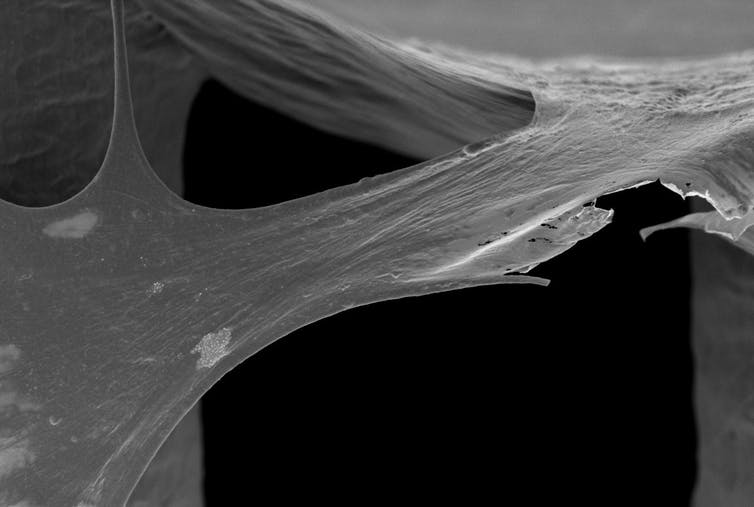 Bone bricks at x750 magnification