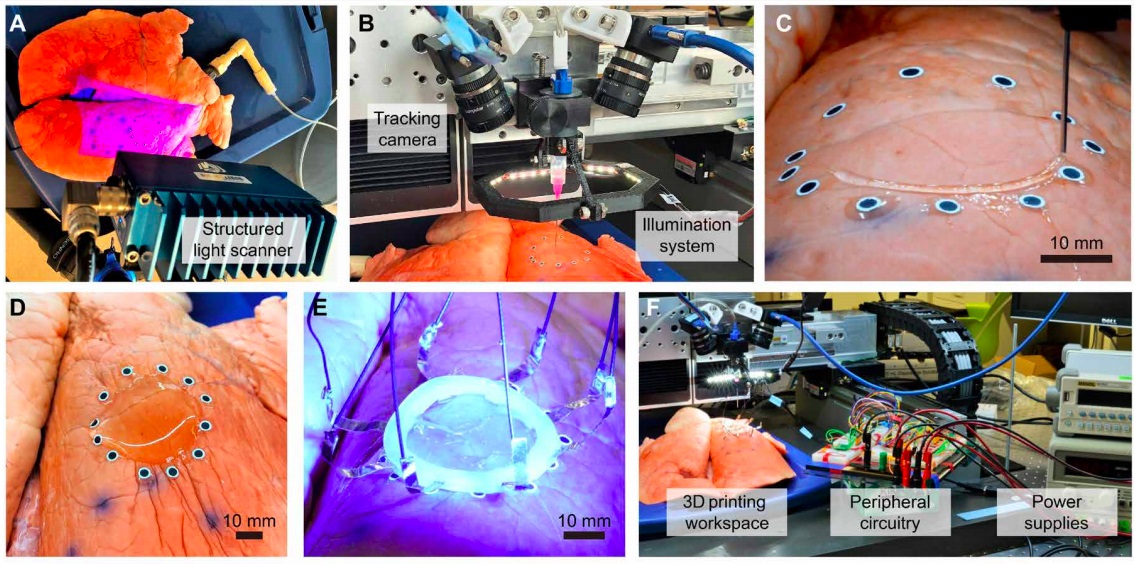 The research team used a dual-camera motion tracking method, which can accurately place the sensor on the pig’s lungs