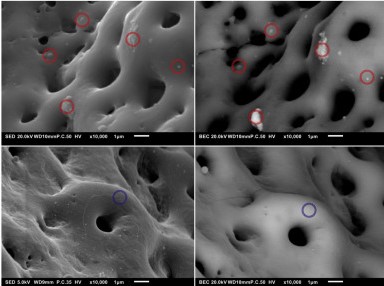  Porous structure of Ti64 implant