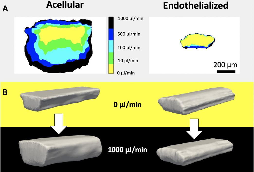 The blood vessel structure of the LLNL team shows the same storage modulus as real human brain tissue