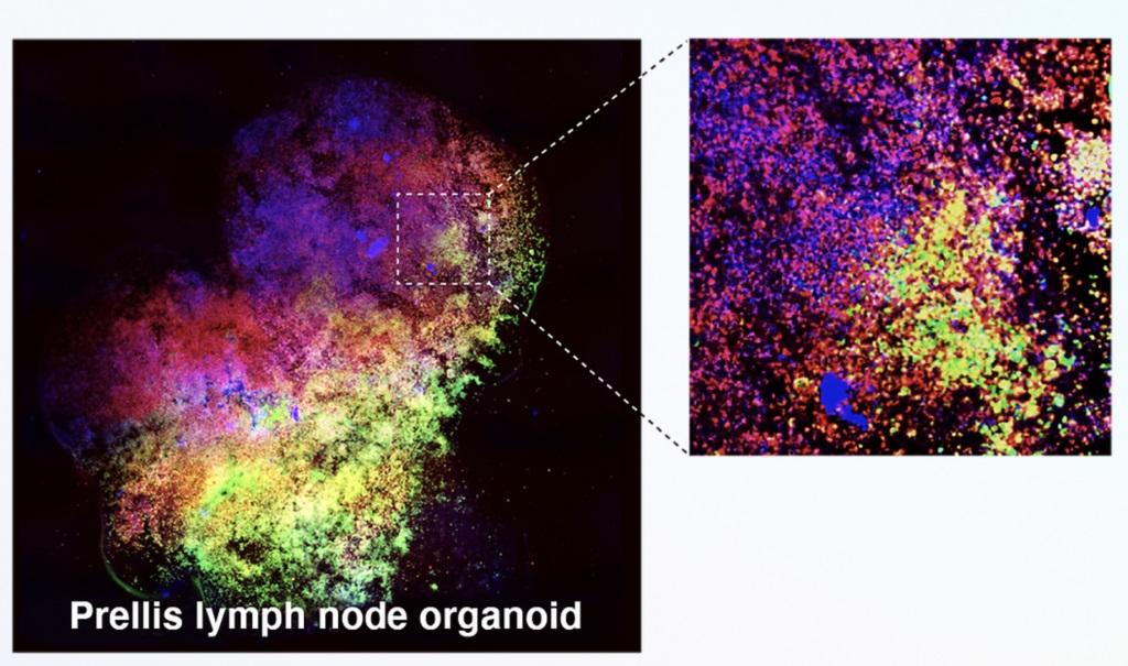 Prellis Biologics' 3D bioprinted high-resolution images of the externalized immune system