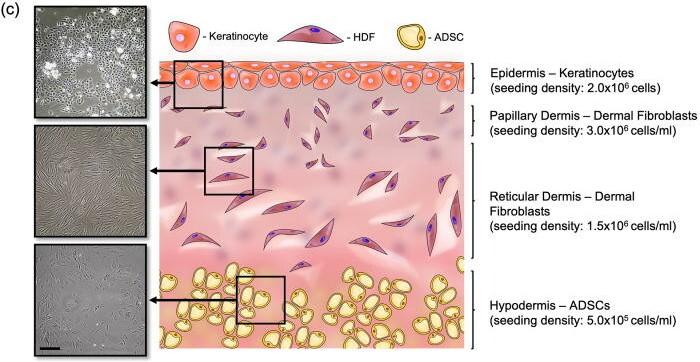 Subcutaneous tissue, dermis and epidermis