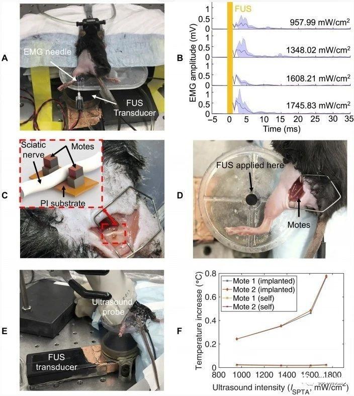 [Breakthrough]The world’s smallest implantable single-chip system, realizing wireless body temperature monitoring and other functions