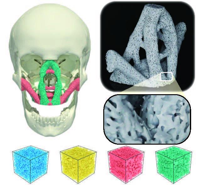Bio-inspired 3D printed facial implants